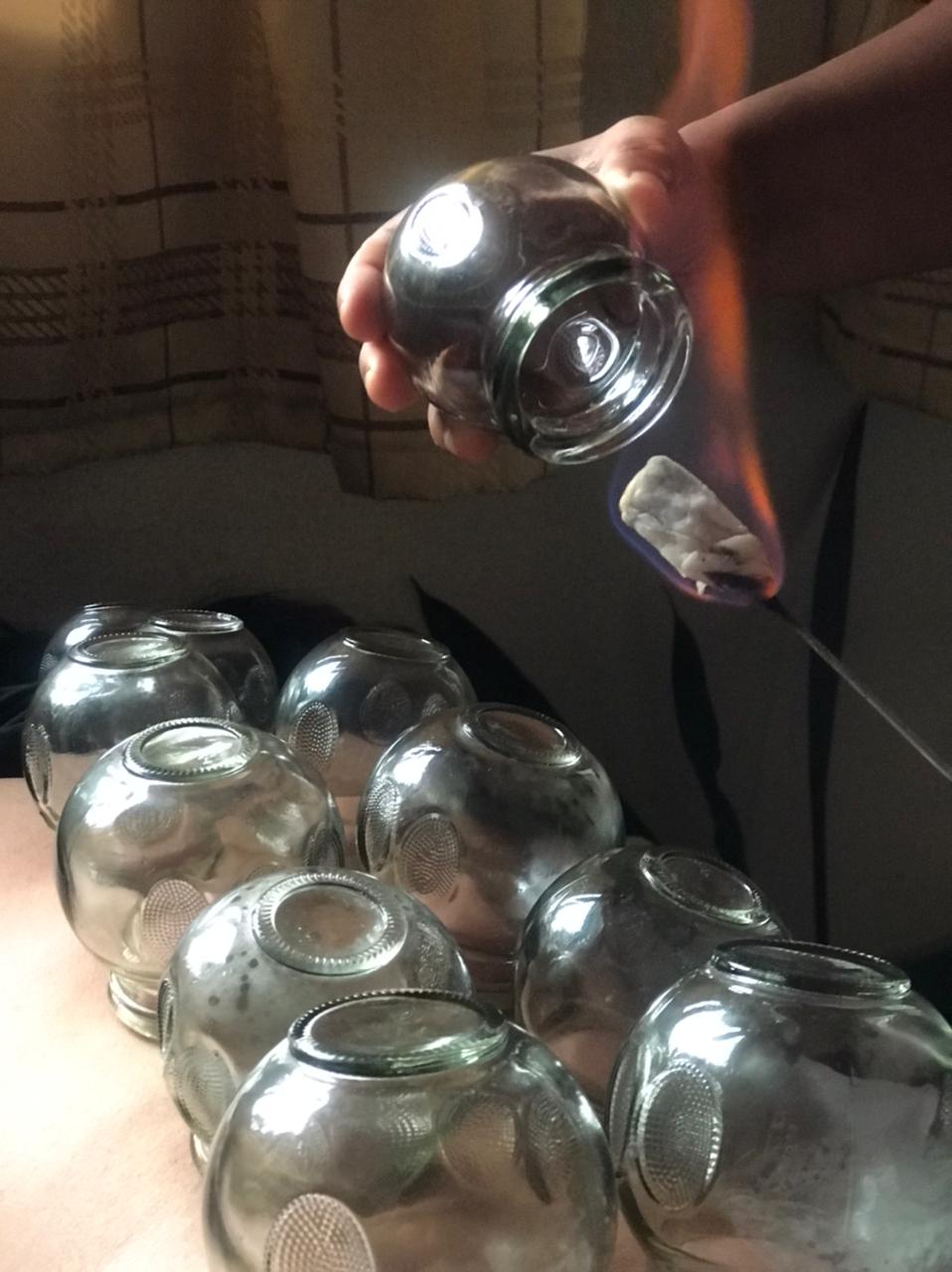 Cupping